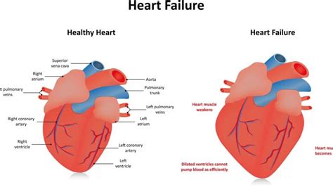 lv hypokinesia|causes of septal hypokinesis.